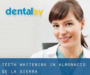 Teeth whitening in Almonacid de la Sierra