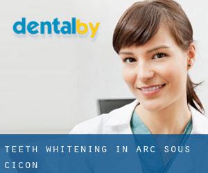 Teeth whitening in Arc-sous-Cicon