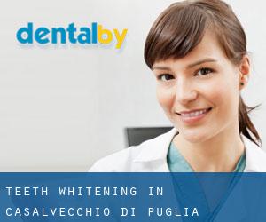 Teeth whitening in Casalvecchio di Puglia