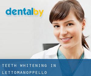 Teeth whitening in Lettomanoppello