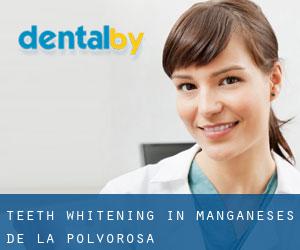 Teeth whitening in Manganeses de la Polvorosa