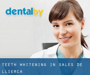 Teeth whitening in Sales de Llierca