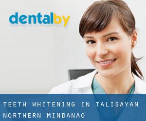 Teeth whitening in Talisayan (Northern Mindanao)