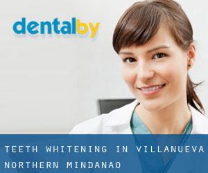 Teeth whitening in Villanueva (Northern Mindanao)