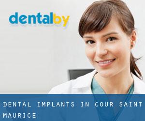 Dental Implants in Cour-Saint-Maurice